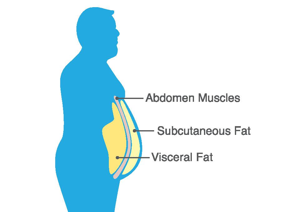 Personalised medicine of obesity: An innovative tool to diagnose visceral  fat » Luxembourg Institute of Health
