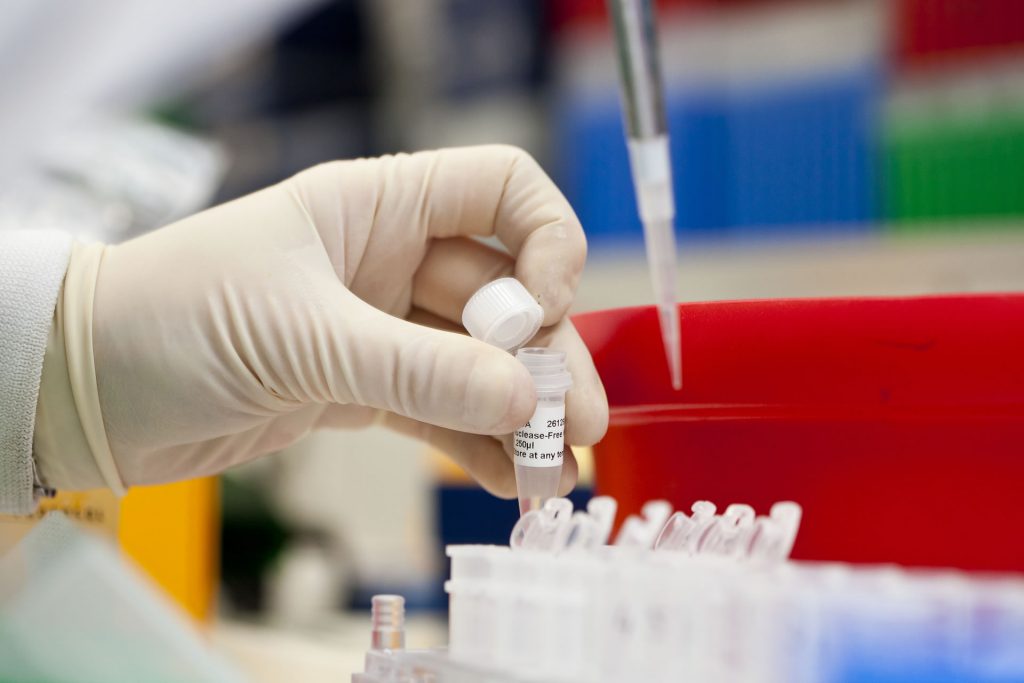 Labor für Experimentelle und Molekulare Immunologie » Luxembourg